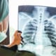 Managing Workplace Risk: Occupational Lung Disease FI