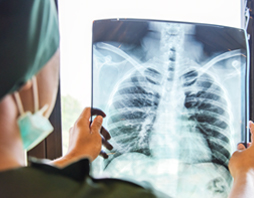Managing Workplace Risk: Occupational Lung Disease FI