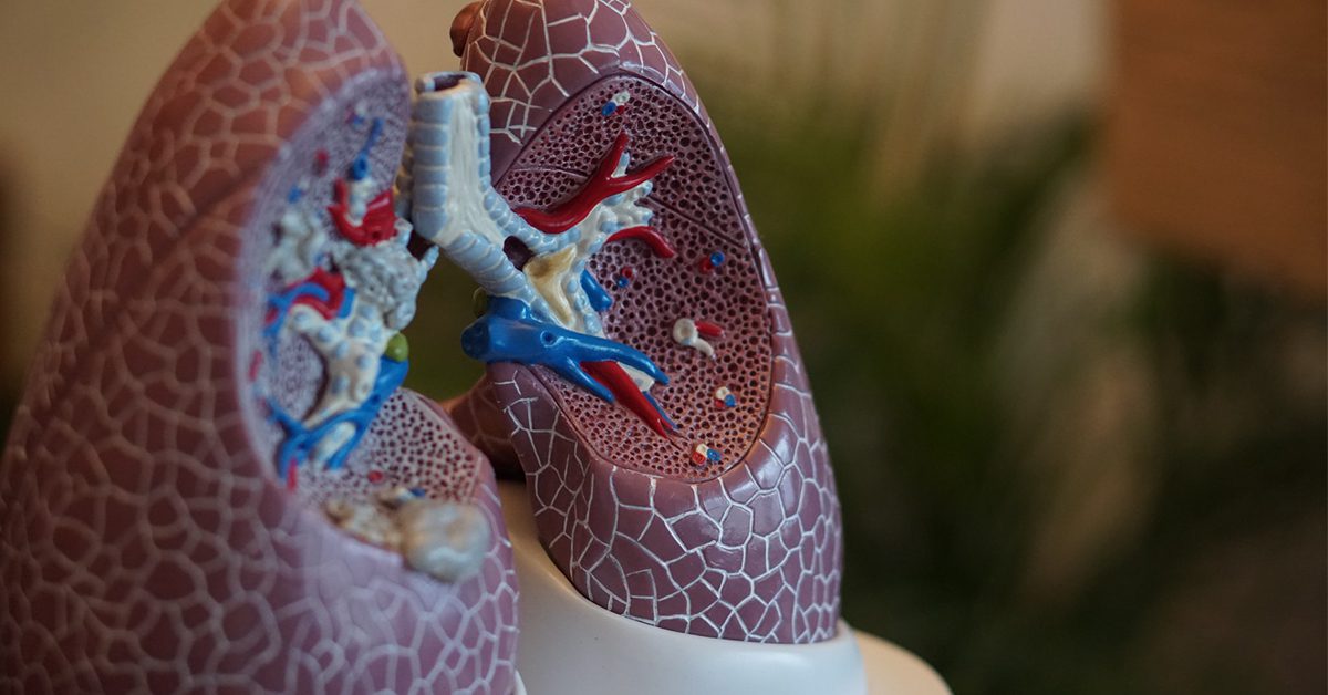 Lung Cancer Awareness month (November 2021) AI Lung Cancer Awareness month (November 2021) AI